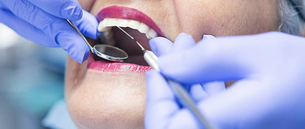 Best Emergency Wisdom Tooth Extraction in Oklahoma, PA